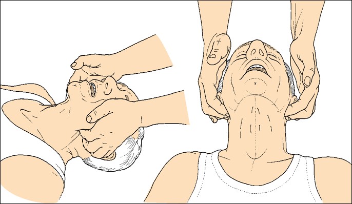 jaw_thrust.jpg
